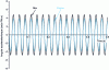 Figure 21 - Engine and gearbox acceleration at 1,000
rpm