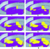 Figure 17 - Development of two-phase zones as upstream pressure decreases (points marked on figure )