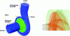 Figure 14 - Assembly of the Nsq 32 impeller-volute assembly. Mesh detail 