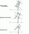 Figure 15 - Space occupied or not by a ring of blades