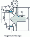 Figure 5 - Leaking single-stage gland packing