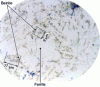 Figure 5 - Microstructure of the F-10D2