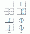 Figure 2 - Stress fields for smooth and notched parts