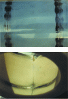 Figure 2 - Localized overstress caused by geometric defects on a sliding contact (bearing) using non-accommodating materials (ceramics)