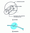 Figure 3 - Rotor bent under the effect of an unbalance