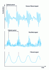 Figure 14 - Detecting and locating bearing defects