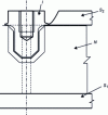 Figure 58 - Assembling an implant in a slat base