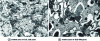 Figure 5 - Micrographs of welds using graphite refractory pads and Fe-Si innoculation