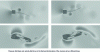 Figure 28 - Coupled simulation