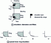 Figure 40 - Shoulders