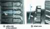 Figure 25 - Contact surfaces concerned