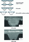 Figure 4 - Gear profiles