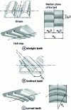 Figure 6 - Belt cross-sections