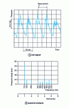 Figure 9 - Pressure vibration spectral analysis