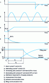 Figure 33 - Valve switching time