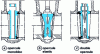 Figure 4 - Angle seat gate valves