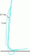 Figure 18 - Wear profiles (reversed) calculated after 0.7 and 2 ms cutting of a carbide tool when machining 42CrMo4 steel (s = 0.25 mm; U0 = 120 m/min; γ = 5˚; α = 6˚; Rα = 0.025 mm) [31][32]