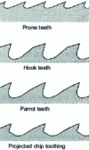 Figure 2 - Tooth shapes for steel band and circular saws (sawmills)