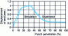 Figure 34 - Sheet metal springback