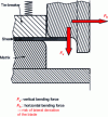 Figure 60 - Unbalanced bending forces