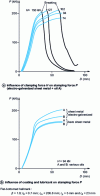 Figure 9 - Deep drawing [24]