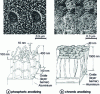 Figure 5 - Morphology of aluminum oxides on 2024 alloy (from [11])