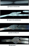 Figure 19 - The different ways of breaking up