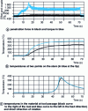 Figure 10 - Recording of force and torque (a) and temperatures at the tool (b) and in the material (c) during welding on light alloys