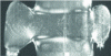 Figure 36 - Cross-section of a PVDF mirror weld