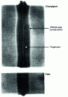 Figure 10 - Longitudinal section of a weld