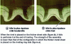 Figure 2 - Importance of assembly direction