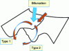 Figure 36 - Bifurcations in a 4D system: in the
displacement (top red arrow) the system arriving at the bottom of
the blue arrow can go either left or right [2].