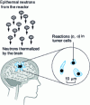 Figure 9 - Treatment concept diagram, based on [7]
