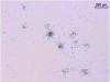 Figure 11 - Fission traces left in Lexan by natural uranium particles 1 to 2 µm in diameter