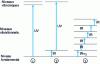 Figure 5 - Principle of different irradiation schemes