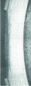 Figure 12 - Corrosion with scaling and hydride precipitation in an irradiated Zircaloy 4 cladding