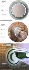 Figure 4 - Illustrative cross-sectional views of a storage package in the usable part of an HA cell.