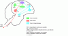 Figure 7 - Telencephalon of a songbird: schematic localization of the main song nuclei responsible for the production, reception and memorization of vocalizations (connections between nuclei are symbolized by arrows); the HVC appears as the orchestra conductor, connected directly or indirectly to all the other nuclei.