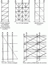 Figure 19 - Different types of shoring