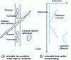 Figure 14 - Principle of reflection-mode drilling
radar