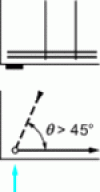 Figure 17 - Tilting a supported connecting rod (, vol. 3)