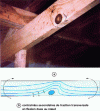 Figure 4 - Failure caused by a node