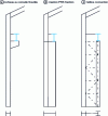 Figure 16 - Common beam support configurations