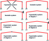 Figure 7 - Gantry static diagrams