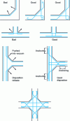 Figure 13 - Reinforcement of recessed and corner walls