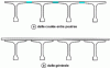 Figure 1 - Possible designs for a post-tensioned girder bridge deck
