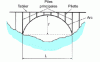 Figure 24 - Schematic representation of an arch with an upper deck