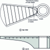 Figure 30 - Damage to all the treads of a prefabricated staircase