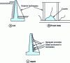 Figure 14 - Buttress wall with reinforcement error