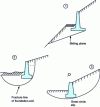 Figure 20 - Different types of overall instability